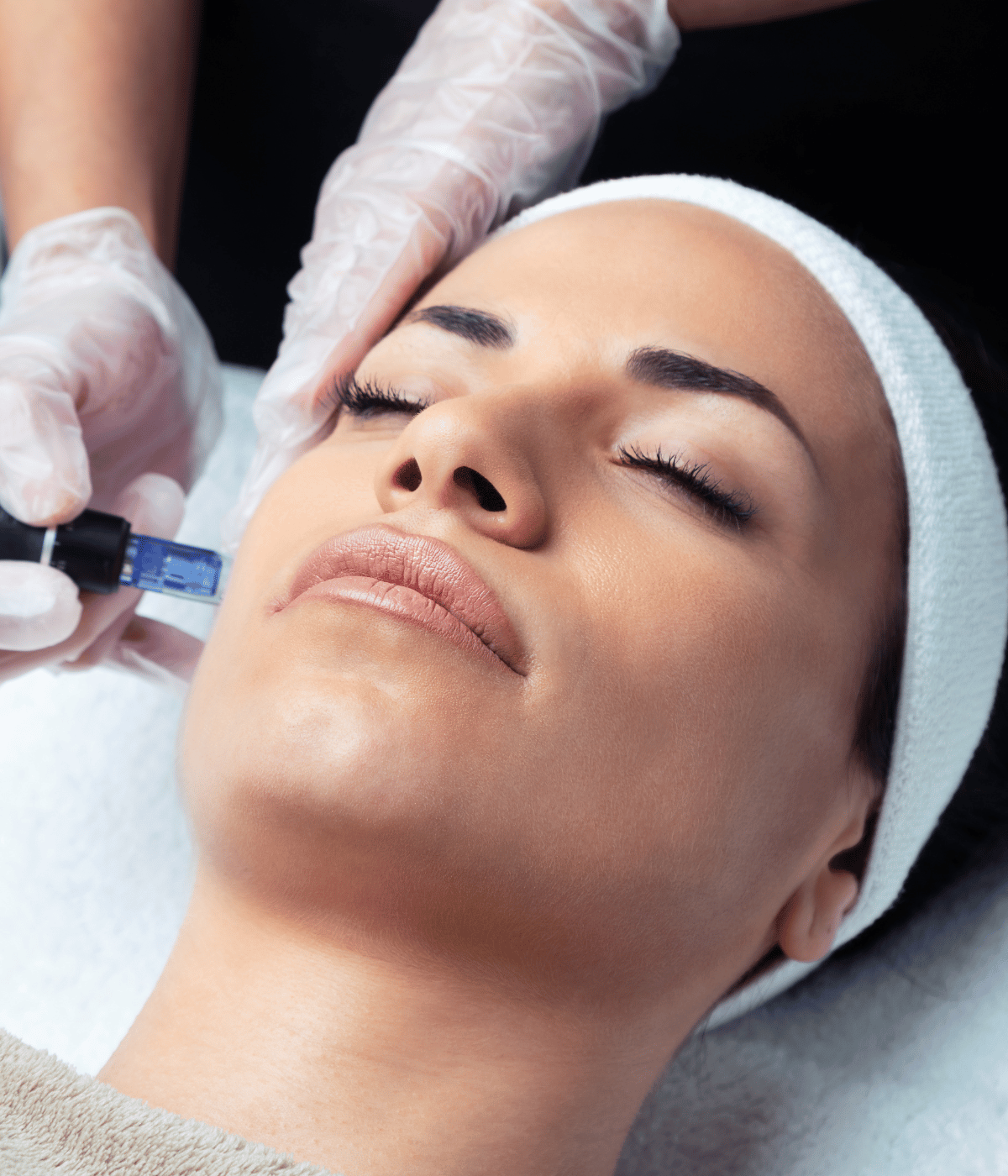 SkinPen Microneedling - DripIV