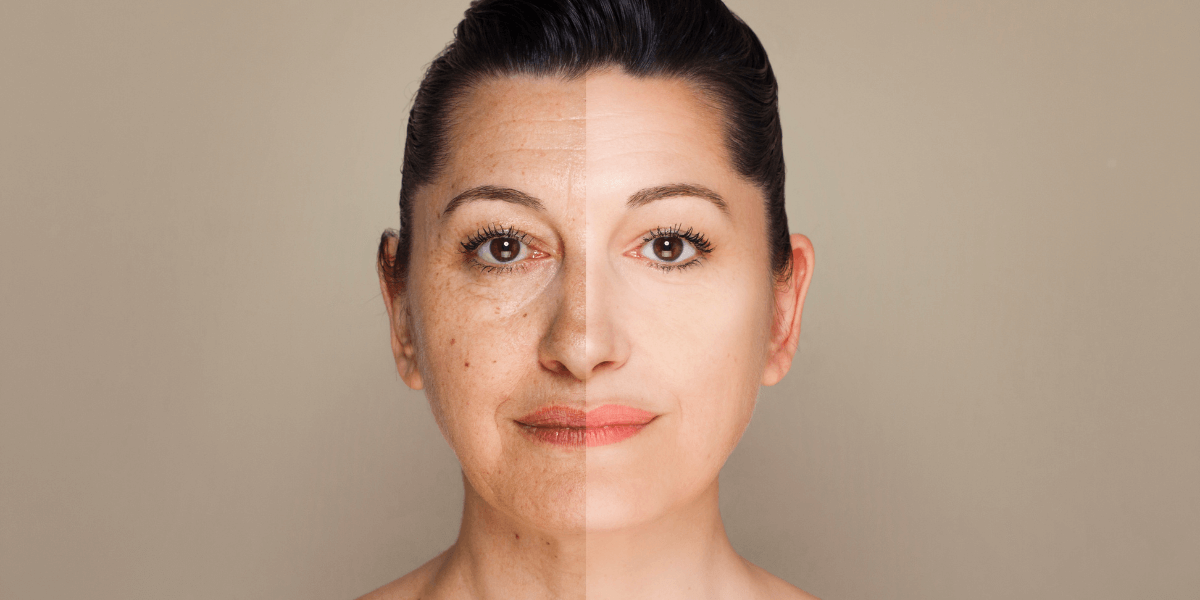 Side by side of a lady. One side is of her looking young and the other side is of her with aging.